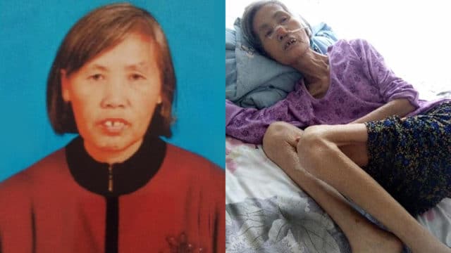 Ms. Zhao before her last arrest and after her release from prison, severely emaciated and missing a front tooth that was knocked out while being force-fed unknown drugs.