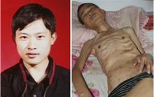 Mr. Xu Dawei, before and after pyschiatric torture