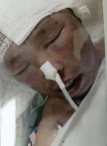 Falun Gong practitioner, Ms. Shi Yunlan after police beat her unconscious in in Wuan City, Hebei Province, China, on October 9, 2014.