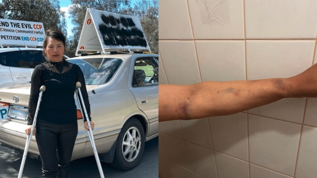 Nancy Dong with her vehicle (left) and bruises (right) in the aftermath of the Floriade Festival attack in Canberra, Australia.